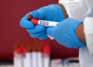 सोमवार को कोरबा जिले में मिले 38 कोरोना संक्रमित