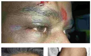 कांग्रेस कार्यकर्ताओं पर हमला: भाजपा प्रत्याशी लखन लाल देवांगन और उनके भाई नरेंद्र के इशारे पर हमले का आरोप